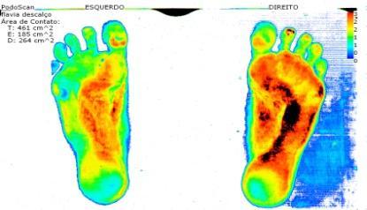 Resultados a Nessa seção serão apresentas as imagens das impressões colorimétricas processadas pelo software Podoscan em que as cores vermelho e preto representam as áreas de maior