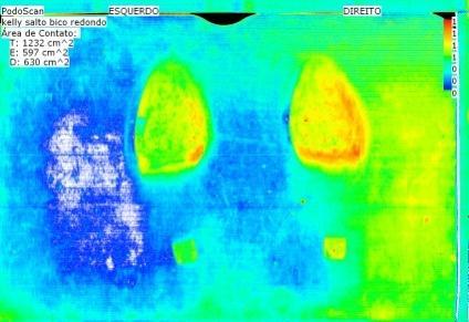 Na Figura 5 e na Figura 6 temos as imagens que foram coletadas com o pé descalço.