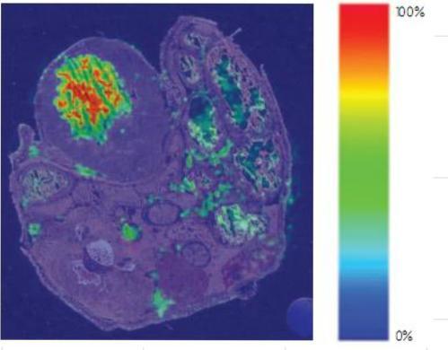 b) Imagens moleculares do composto, alta concentração no tumor e baixa