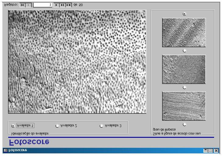 Material e método Figura 7. Interface gráfica do software Fotoscore, desenvolvido para a automação da atribuição de escores às fotomicrografias.
