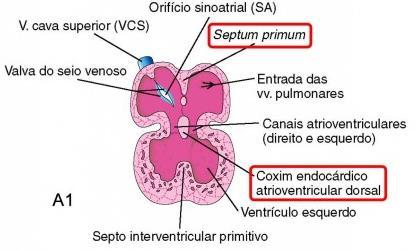 septo primário septum primum forame primário foramen