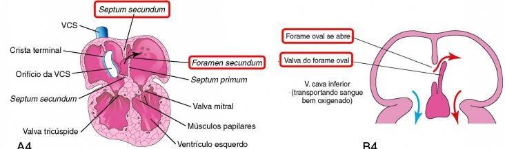 SEPTAÇÃO DO ATRIO PRIMITIVO Septo primário aderido aos coxins endocárdicos = valva do forame oval = impedindo o refluxo do sangue do