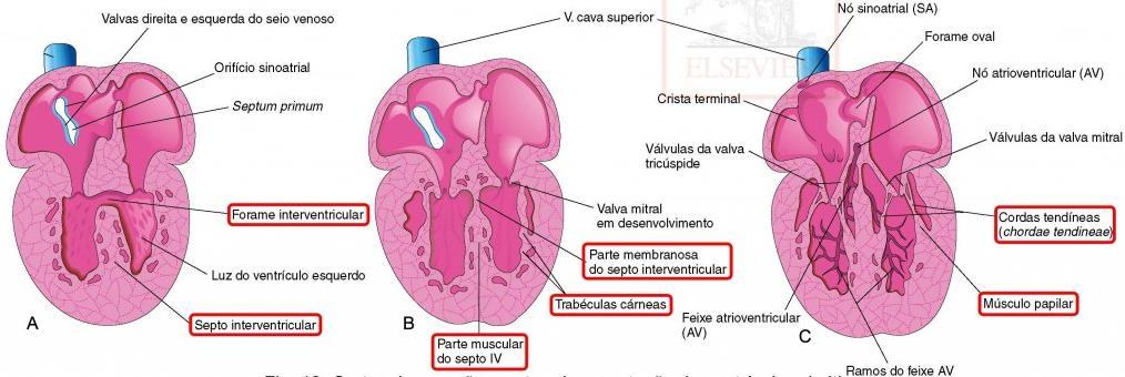 FORMAÇÃO DAS ARTÉRIAS septo interventricular = movimento ascendente, do assoalho do ventrículo em direção ao coxim endocárdio forame