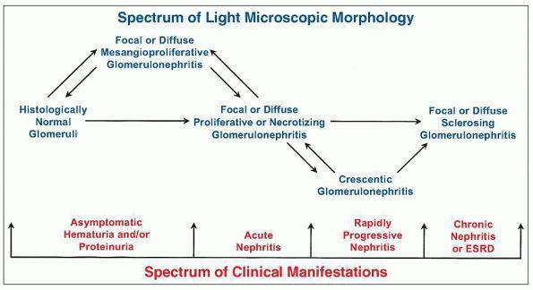 Diagrama de correlação entre padrões histopatológicos de lesão glomerular e manifestações clínicas.