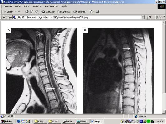 Sistemas de Imagens/ Radiologia Tipos de Imagens (Rx, USG, CT, MRI, Ecocardiograma, Doppler, Angiografias, etc.