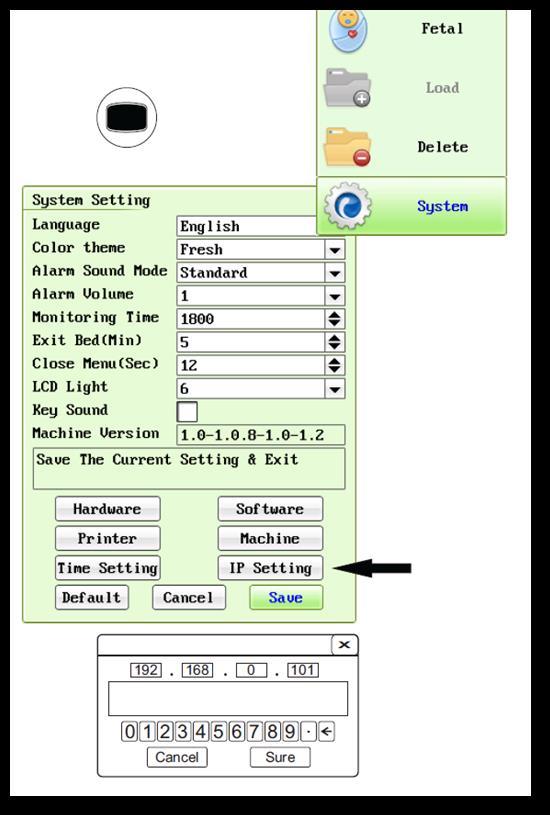 3.2 Parâmetros iniciais do equipamento 3.2.1 Configurações de IP no CARDIOTOCÓGRAFO 1) Pressione botão MENU do seu CARDIOTOCÓGRAFO; 2) Acesse SYSTEM; 3) Acesse IP SETTING; 4) Digite o endereço de