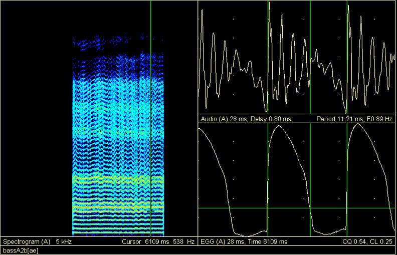 Formas de onda Consegue se visualizar ao mesmo tempo o sinal áudio do microfone e o sinal do electroglotógrafo (EGG) que permite seguir o padrão do contacto das pregas vocais no ciclo glótico.