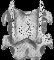 transversos articular