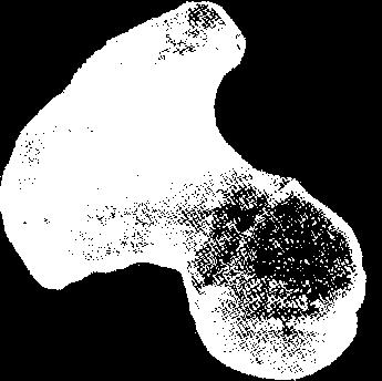 Incisura Trocantérica Fóve a