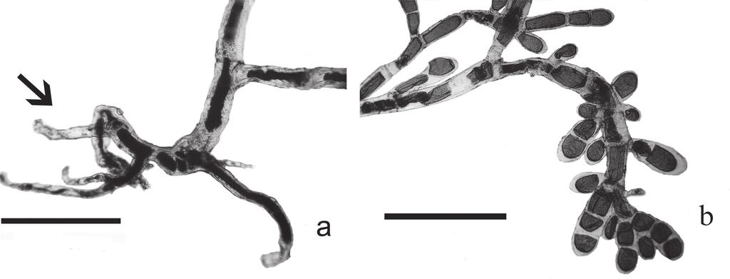 Gisa Eneida Marques Machado, Cristina Aparecida Gomes Nassar e Maria Teresa Menezes de Széchy Figura 4. Cladophora cf. pygmaea Reinke (Chlorophyta) do Núcleo Picinguaba (PESM), Ubatuba, São Paulo. a.