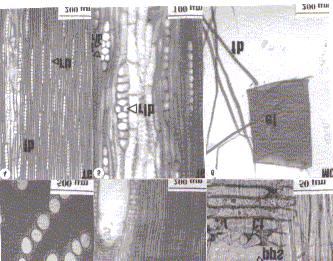 100 Fabrowski, F.J. et al. FIGURA 1: Fotomicrografias do lenho de Eucalyptus smithii R.T. Baker.