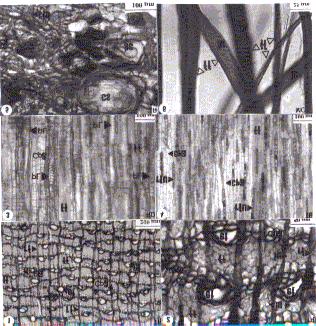 102 Fabrowski, F.J. et al. FIGURA 2: Fotomicrografias da casca de Eucalyptus smithii R.T. Baker.