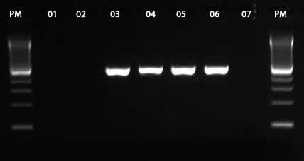 5.7.5 Mecanismos de Resistência Antimicrobiana Os genes de resistência antimicrobiana avaliados estão descritos na Tabela 2. As figuras 10-12 ilustram resultados de PCRs obtidos das amostras testadas.