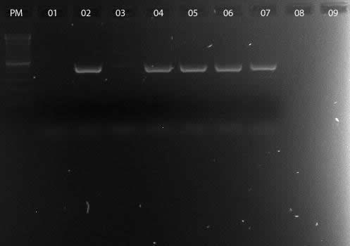 Figura 11: Foto de PCR para a detecção de gene OXA 23 em amostras de A.