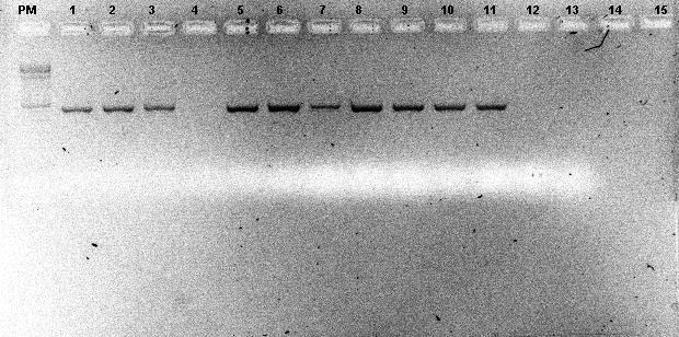 Figura 18: PCR para a detecção de genes de bomba de efluxo de clorexidina: AdeB nas amostras de A.