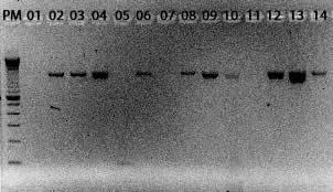 Figura 20: PCR para a detecção de genes de bomba de efluxo Ade A em amostras de A.