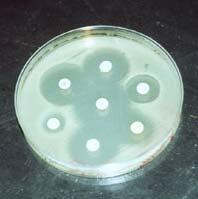 10 Figura 4: Teste de susceptibilidade aos antimicrobianos pelo método de Kirby-Bauer (Disco-difusão).