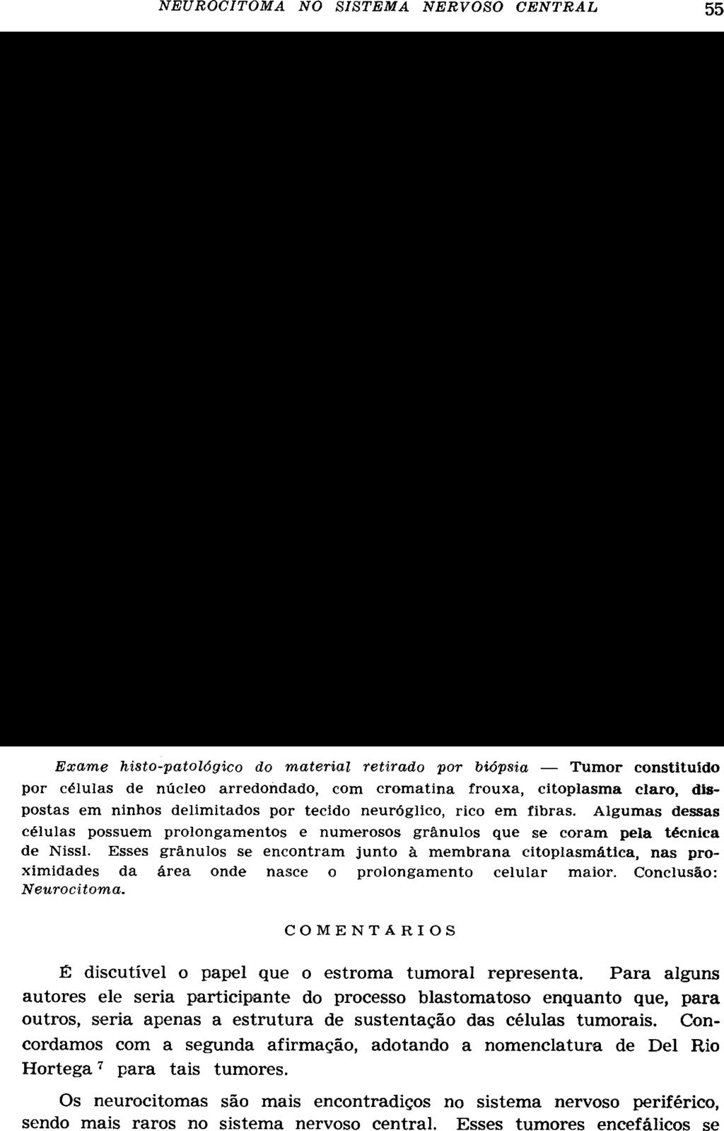 Exame histo-patológico do material retirado por biópsia Tumor constituido por células de núcleo arredondado, com cromatina frouxa, citoplasma claro, dispostas em ninhos delimitados por tecido