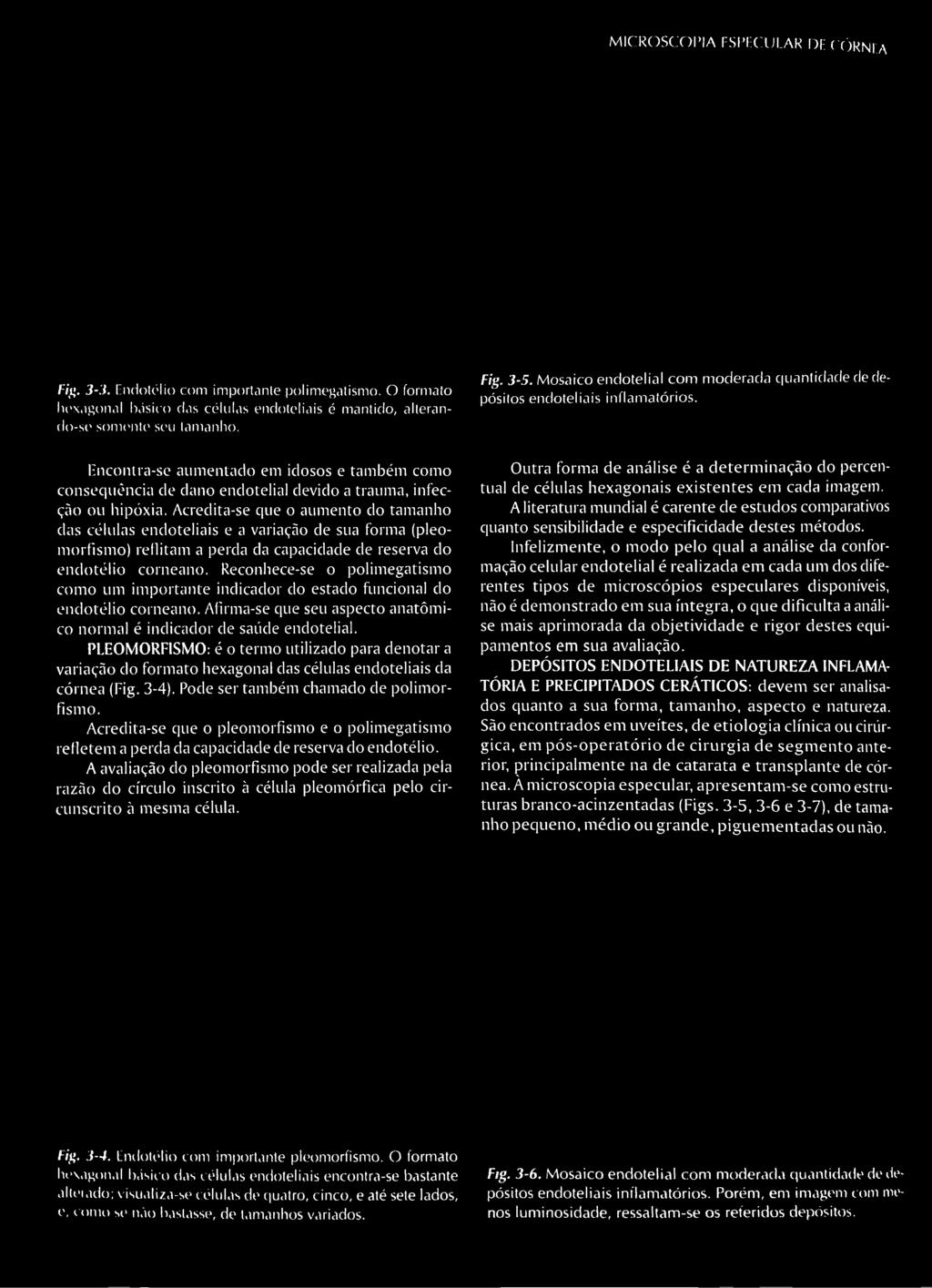 PLEOMORFISMO: é o termo utilizado para denotar a variação do formato hexagonal das células endoteliais da córnea (Fig. 3-4). Pode ser também chamado de polimorfismo.