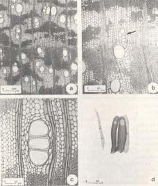 38 Anatomia da madeira e casca do espinilho Acacia caven (Mol.) Mol. 39 FIGURA 2: Fotomicrografia da madeira. A. Secção transversal, estacando a porosidade difusa e arranjo do parênquima axial. B.