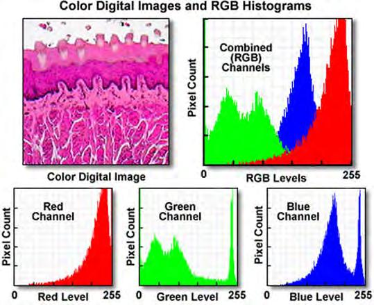 Histogramas e contraste nas imagens digitais: 28>