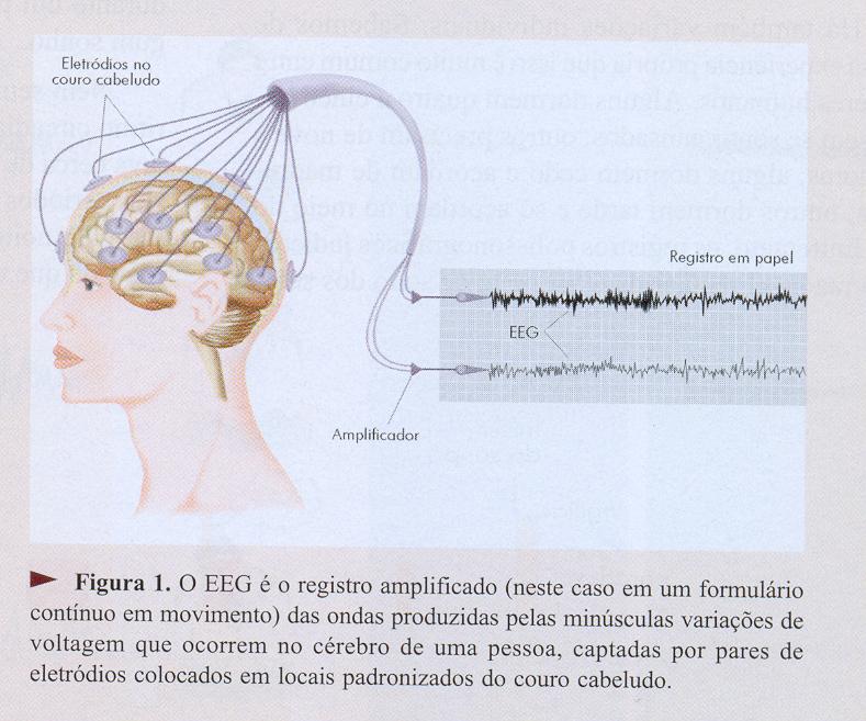 Registro Encefalográfico O registro eletroencefalográfico é realizado através de eletrodos afixados com um gel condutor de eletricidade à pele.