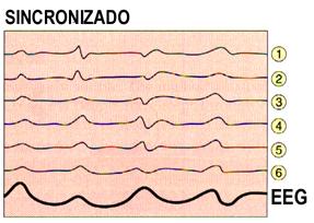 A atividade talâmica é regulada pelo sistema de modulação difuso SONO EEG de ondas lentas VIGÍLIA EEG de ondas rápidas CÓRTEX
