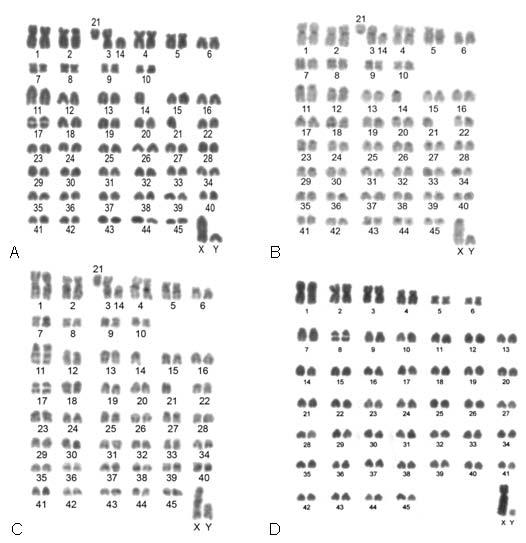 A B C D Figura 4: Cariótipos de Phyllomys.