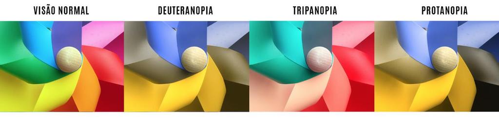 23 Figura 06: Visão do Daltônico Fonte: Tipos de Daltônicos, 2017 3.3. Sintomas Os sinais e sintomas de daltonismo costumam variar de intensidade conforme a pessoa e de acordo com o tipo do distúrbio.