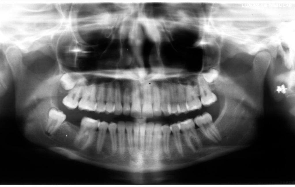 19 Figura 1: Radiografia