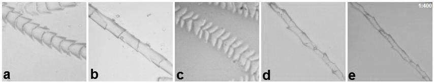 Impressões cuticulares de pelos guarda de Família Vespertilionidae (padrão folidáceo estreito): (a) Eptesicus furinalis; (b) Lasiurus cinereus; (c) Eptesicus