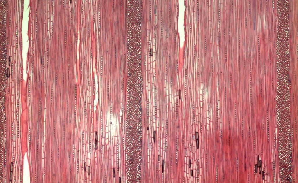 Seção transversal microscópica da madeira de Quercus rubra L. (Aumento: 4X).