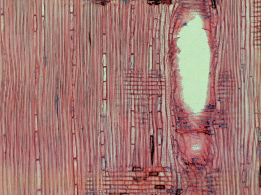 Raios homogêneos Traqueídes vasicêntricos Figura 11. Seção longitudinal radial microscópica da madeira de Quercus rubra L. (Aumento: 10X). 5.