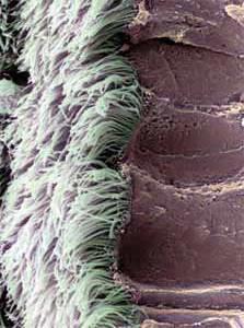 - Presença de epitélio ciliado com glândulas caliciformes