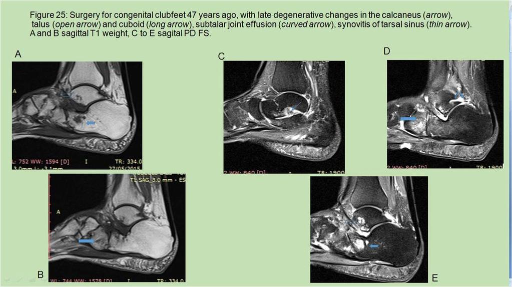 19: FIG. 25.