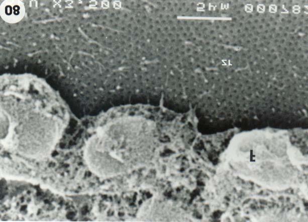 Morfologia da micrópila e da superfície dos ovócitos de piracanjuba 229 envelope folicular em torno do ovócito, sendo constituído por teca, membrana basal, epitélio folicular e zona radiata.