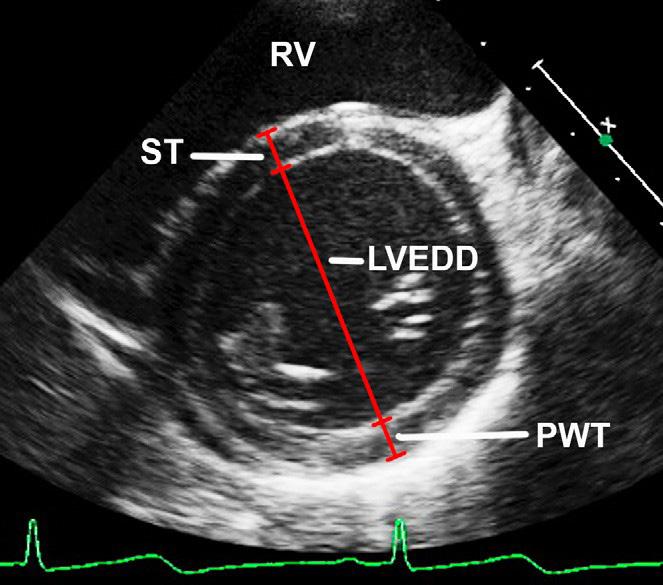 Figura 6 Medida do diâmetro interno do eixo menor (eixo curto) do ventrículo esquerdo (LVEDD), espessura da parede posterior do VE (PWT) e espessura do septo (ST) no plano paraesternal eixo curto, ao