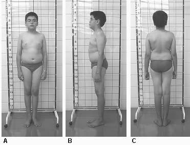 Figura 2: A- Plano Frontal, B- Plano Sagital e C- Plano Dorsal (Reavaliação postural).