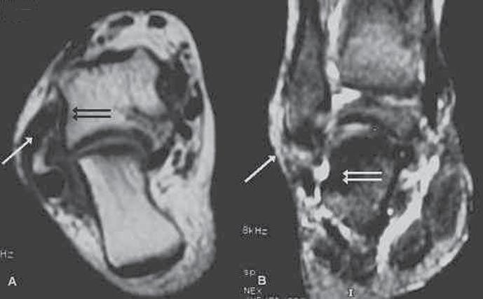 Lima CMAO et al.