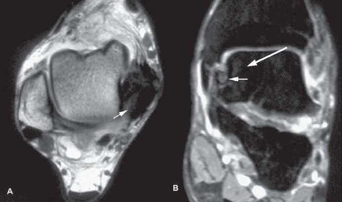 Lima CMAO et al. Figura 4.