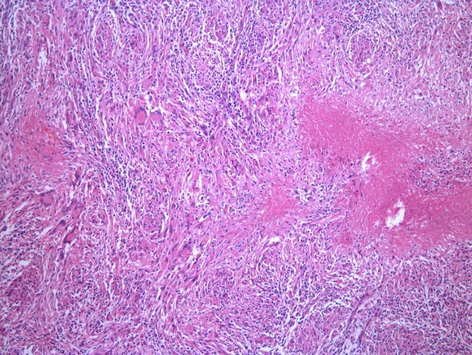 21 3. RESULTADOS De janeiro de 2007 a dezembro de 2011 foram diagnosticados 60 casos de tuberculose em bovinos e 57 casos de linfadenite granulomatosa em suínos.