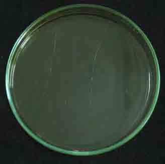 Resultado 107 C.albicans B. subtilis FIGURA 15 - Placas de Petri com as semeaduras dos microrganismos referentes ao grupo experimental Para o microrganismo P.