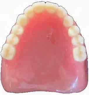 Material e método 84 uma mistura pastosa de água com branco de Espanha conferiu brilho adequado à prótese (Figura 6).