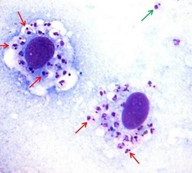 LEISHMANIOSE Fagocitose do parasita Vacúolo parasitóforo Multiplicação do parasita Enzimas lisossômicas Rompimento da célula parasitada Sangue Nova célula parasitada LEISHMANIOSE Disseminação