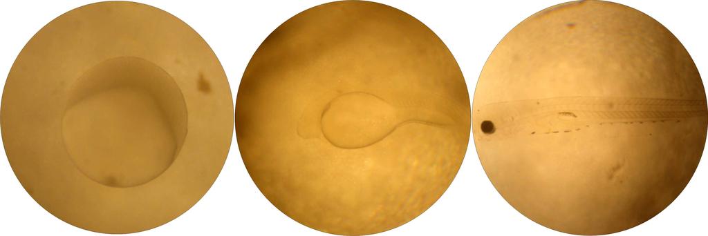 a b c Figura 2 - Estágios de desenvolvimentos embrionário do piau-de-vara Schizodon fasciatus Spix & Agassiz, 1829: (a) Clivagem, (b) larval vitelino e (c) pré-flexão. Sales et al.