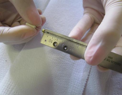 O cursor da lima foi ajustado na referência coronal e realizada a medida em régua endodôntica.