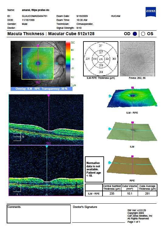 43 1 2 3 4 5 7 8 6 9 10 Figura 9 Modelo de exame Mácula Impresso gerado pelo Cirrus OCT.