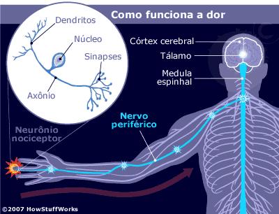 Somatossensação DOR mecanismo de proteção Nociceptor : receptor para estímulo nocivo, terminação nervosa não