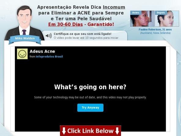 More information >>> HERE <<< Acabar Com Espinhas 1 Dia - Best Way To Get Eliminar Espinhas & Cravos (Mike Walden) - EBook Acabar com espinhas 1 dia - best way to get eliminar espinhas & cravos (mike