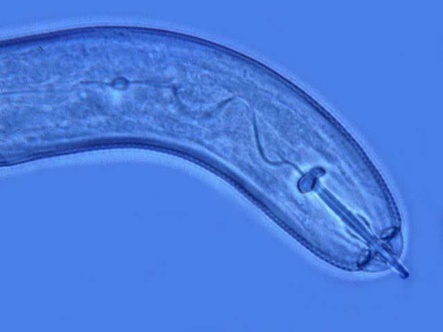 Juvenil de Heterodera sp. http://www.uni-kiel.de/phytomed/video.html/heterodera.